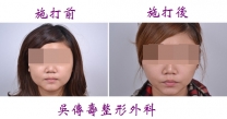 國字臉